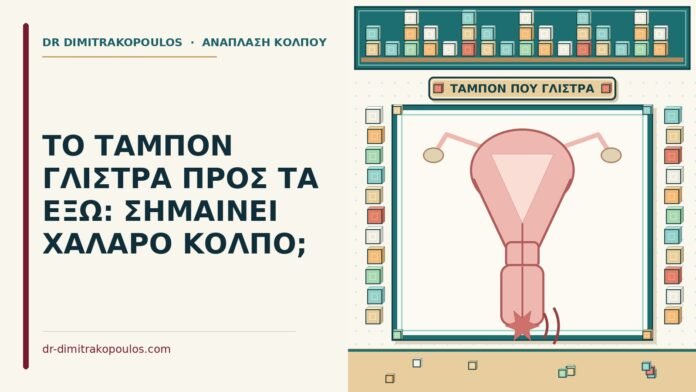 ΤΟ ΤΑΜΠΟΝ ΓΛΙΣΤΡΑ ΠΡΟΣ ΤΑ ΕΞΩ: ΣΗΜΑΙΝΕΙ ΧΑΛΑΡΟ ΚΟΛΠΟ; ταμπόν που γλιστρά προς τα έξω