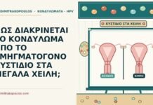 ΠΩΣ ΔΙΑΚΡΙΝΕΤΑΙ ΤΟ ΚΟΝΔΥΛΩΜΑ ΑΠΟ ΤΟ ΣΜΗΓΜΑΤΟΓΟΝΟ ΚΥΣΤΙΔΙΟ ΣΤΑ ΜΕΓΑΛΑ ΧΕΙΛΗ; σμηγματογόνο κυστίδιο