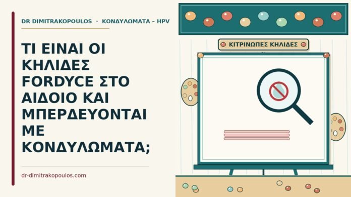 ΤΙ ΕΙΝΑΙ ΟΙ ΚΗΛΙΔΕΣ FORDYCE ΣΤΟ ΑΙΔΟΙΟ ΚΑΙ ΜΠΕΡΔΕΥΟΝΤΑΙ ΜΕ ΚΟΝΔΥΛΩΜΑΤΑ; κηλίδες Fordyce
