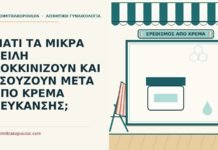 κρέμα λεύκανσης
