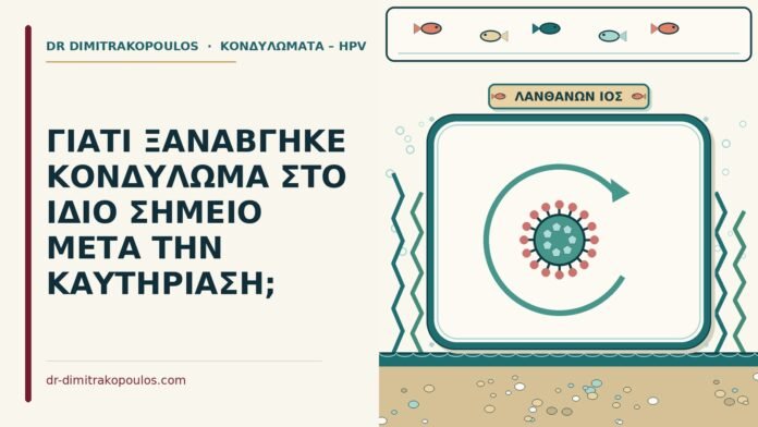 ΓΙΑΤΙ ΞΑΝΑΒΓΗΚΕ ΚΟΝΔΥΛΩΜΑ ΣΤΟ ΙΔΙΟ ΣΗΜΕΙΟ ΜΕΤΑ ΤΗΝ ΚΑΥΤΗΡΙΑΣΗ; κονδύλωμα στο ίδιο σημείο μετά την καυτηρίαση