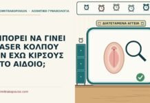 laser κόλπου με κιρσούς