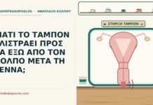 ΓΙΑΤΙ ΤΟ ΤΑΜΠΟΝ ΓΛΙΣΤΡΑΕΙ ΠΡΟΣ ΤΑ ΕΞΩ ΑΠΟ ΤΟΝ ΚΟΛΠΟ ΜΕΤΑ ΤΗ ΓΕΝΝΑ; ταμπόν που γλιστράει μετά τη γέννα