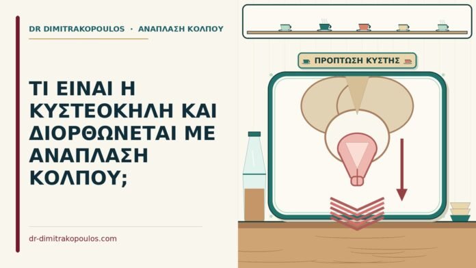 ΤΙ ΕΙΝΑΙ Η ΚΥΣΤΕΟΚΗΛΗ ΚΑΙ ΔΙΟΡΘΩΝΕΤΑΙ ΜΕ ΑΝΑΠΛΑΣΗ ΚΟΛΠΟΥ; κυστεοκήλη