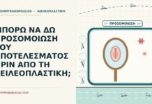 ΜΠΟΡΩ ΝΑ ΔΩ ΠΡΟΣΟΜΟΙΩΣΗ ΤΟΥ ΑΠΟΤΕΛΕΣΜΑΤΟΣ ΠΡΙΝ ΑΠΟ ΤΗ ΧΕΙΛΕΟΠΛΑΣΤΙΚΗ; προσομοίωση του αποτελέσματος της χειλεοπλαστικής