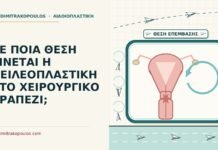 θέση στο χειρουργικό τραπέζι για χειλεοπλαστική