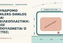 χειλεοπλαστική σε σύνδρομο Ehlers-Danlos