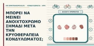 ανοιχτόχρωμο σημάδι