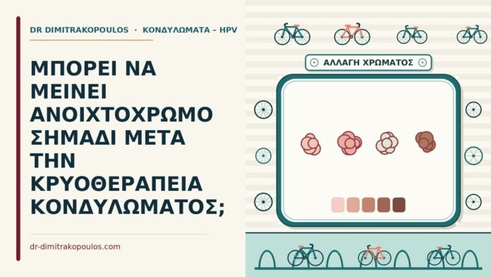 ανοιχτόχρωμο σημάδι