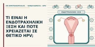 ενδοτραχηλική ξέση