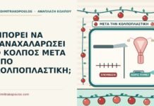 ΜΠΟΡΕΙ ΝΑ ΞΑΝΑΧΑΛΑΡΩΣΕΙ Ο ΚΟΛΠΟΣ ΜΕΤΑ ΑΠΟ ΚΟΛΠΟΠΛΑΣΤΙΚΗ; κόλπος μετά από κολποπλαστική