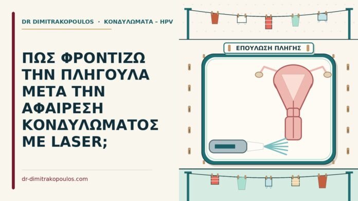 ΠΩΣ ΦΡΟΝΤΙΖΩ ΤΗΝ ΠΛΗΓΟΥΛΑ ΜΕΤΑ ΤΗΝ ΑΦΑΙΡΕΣΗ ΚΟΝΔΥΛΩΜΑΤΟΣ ΜΕ LASER; αφαίρεση κονδυλώματος με laser