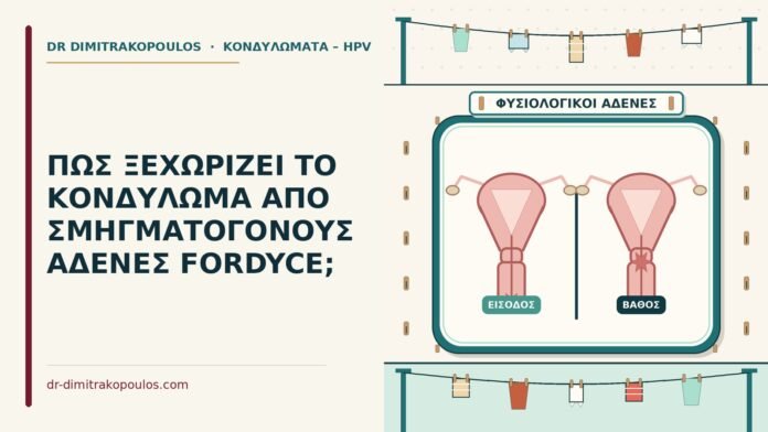 αδένες fordyce