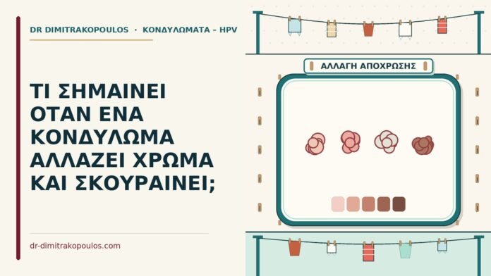 κονδύλωμα αλλάζει χρώμα