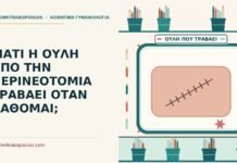 ουλή από την περινεοτομία
