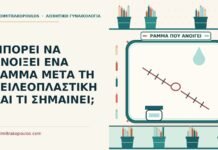 ανοίξει ένα ράμμα