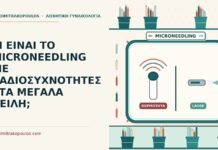 ΤΙ ΕΙΝΑΙ ΤΟ MICRONEEDLING ΜΕ ΡΑΔΙΟΣΥΧΝΟΤΗΤΕΣ ΣΤΑ ΜΕΓΑΛΑ ΧΕΙΛΗ; microneedling με ραδιοσυχνότητες