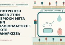αποτρίχωση laser