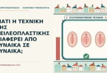 τεχνική της χειλεοπλαστικής