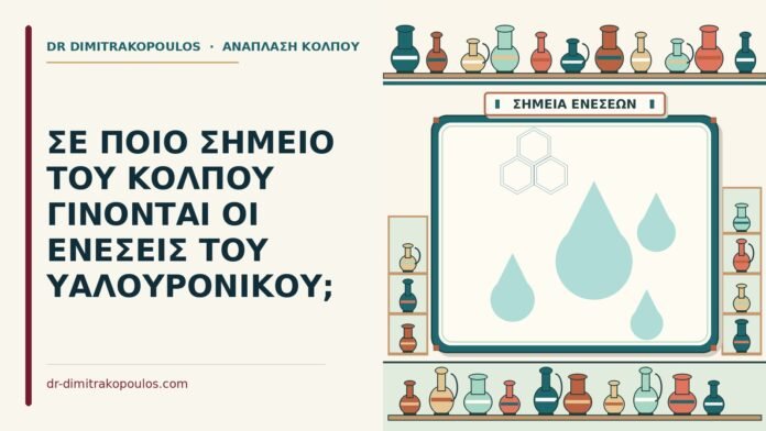 ΣΕ ΠΟΙΟ ΣΗΜΕΙΟ ΤΟΥ ΚΟΛΠΟΥ ΓΙΝΟΝΤΑΙ ΟΙ ΕΝΕΣΕΙΣ ΤΟΥ ΥΑΛΟΥΡΟΝΙΚΟΥ; ενέσεις του υαλουρονικού