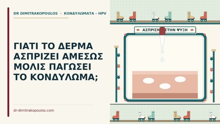 ασπρίζει το κονδύλωμα στην κρυοθεραπεία