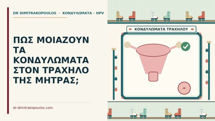 ΠΩΣ ΜΟΙΑΖΟΥΝ ΤΑ ΚΟΝΔΥΛΩΜΑΤΑ ΣΤΟΝ ΤΡΑΧΗΛΟ ΤΗΣ ΜΗΤΡΑΣ; κονδυλώματα στον τράχηλο της μήτρας