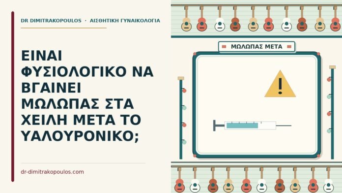 ΕΙΝΑΙ ΦΥΣΙΟΛΟΓΙΚΟ ΝΑ ΒΓΑΙΝΕΙ ΜΩΛΩΠΑΣ ΣΤΑ ΧΕΙΛΗ ΜΕΤΑ ΤΟ ΥΑΛΟΥΡΟΝΙΚΟ; μώλωπας στα χείλη μετά το υαλουρονικό