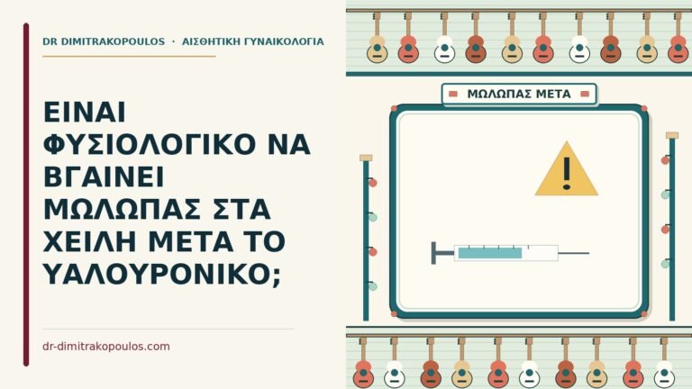 μώλωπας στα χείλη μετά το υαλουρονικό