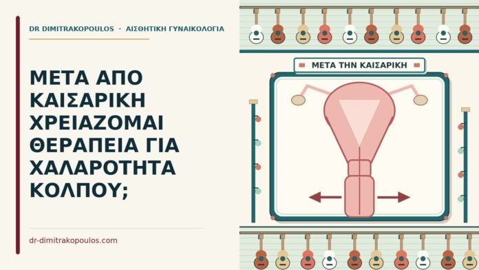 χαλαρότητα κόλπου μετά από καισαρική