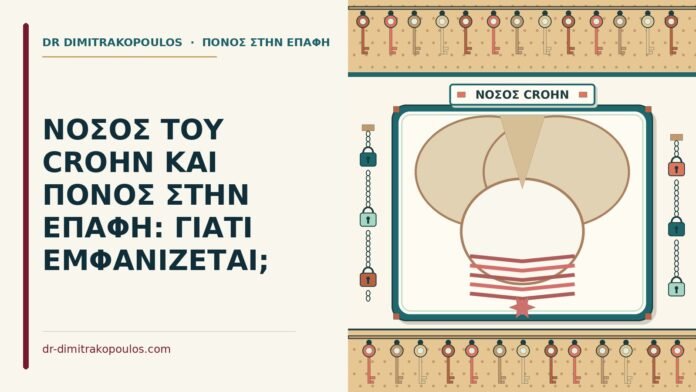 ΝΟΣΟΣ ΤΟΥ CROHN ΚΑΙ ΠΟΝΟΣ ΣΤΗΝ ΕΠΑΦΗ: ΓΙΑΤΙ ΕΜΦΑΝΙΖΕΤΑΙ; νόσος του Crohn