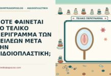 ΠΟΤΕ ΦΑΙΝΕΤΑΙ ΤΟ ΤΕΛΙΚΟ ΠΕΡΙΓΡΑΜΜΑ ΤΩΝ ΧΕΙΛΕΩΝ ΜΕΤΑ ΤΗΝ ΑΙΔΟΙΟΠΛΑΣΤΙΚΗ; τελικό περίγραμμα