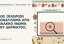 ΠΩΣ ΞΕΧΩΡΙΖΩ ΚΟΝΔΥΛΩΜΑ ΑΠΟ ΜΑΛΑΚΟ ΙΝΩΜΑ ΤΟΥ ΔΕΡΜΑΤΟΣ; μαλακό ίνωμα