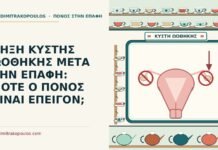 ρήξη κύστης ωοθήκης