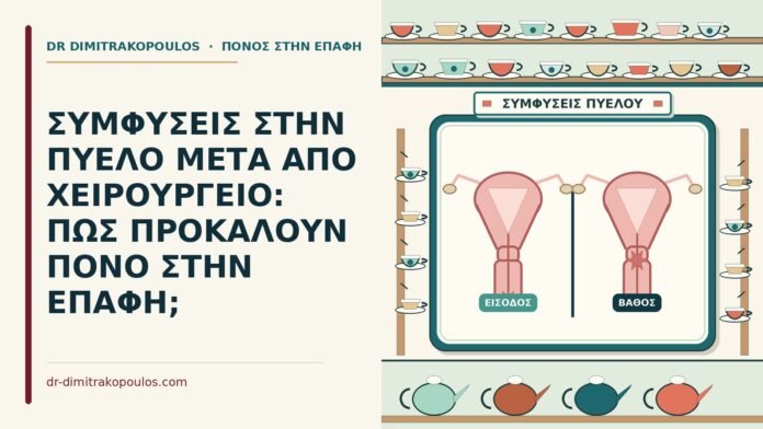 ΣΥΜΦΥΣΕΙΣ ΣΤΗΝ ΠΥΕΛΟ ΜΕΤΑ ΑΠΟ ΧΕΙΡΟΥΡΓΕΙΟ: ΠΩΣ ΠΡΟΚΑΛΟΥΝ ΠΟΝΟ ΣΤΗΝ ΕΠΑΦΗ; συμφύσεις στην πύελο