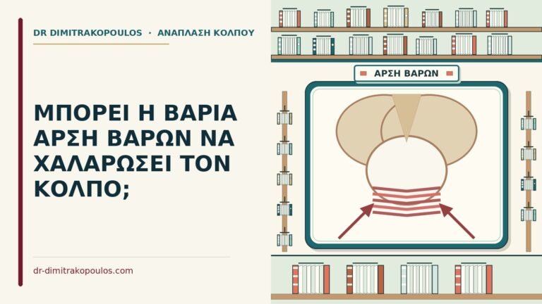άρση βαρών