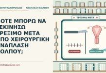 ΠΟΤΕ ΜΠΟΡΩ ΝΑ ΞΕΚΙΝΗΣΩ ΤΡΕΞΙΜΟ ΜΕΤΑ ΑΠΟ ΧΕΙΡΟΥΡΓΙΚΗ ΑΝΑΠΛΑΣΗ ΚΟΛΠΟΥ; τρέξιμο μετά από χειρουργική ανάπλαση
