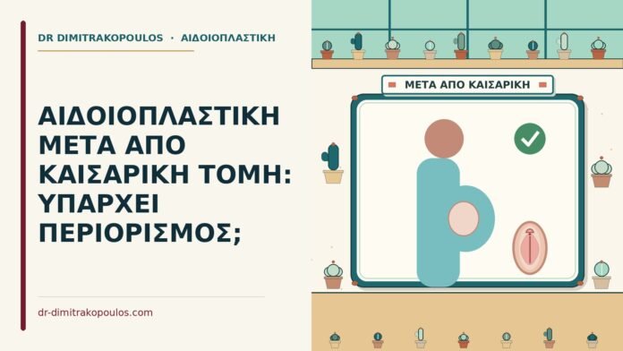 αιδοιοπλαστική