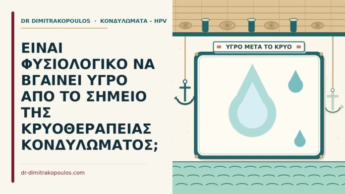 κρυοθεραπεία