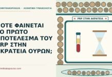 ΠΟΤΕ ΦΑΙΝΕΤΑΙ ΤΟ ΠΡΩΤΟ ΑΠΟΤΕΛΕΣΜΑ ΤΟΥ PRP ΣΤΗΝ ΑΚΡΑΤΕΙΑ ΟΥΡΩΝ; αποτέλεσμα του PRP στην ακράτεια ούρων