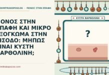 κύστη Βαρθολίνη