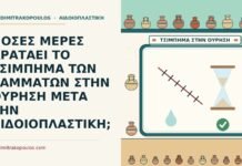 ΠΟΣΕΣ ΜΕΡΕΣ ΚΡΑΤΑΕΙ ΤΟ ΤΣΙΜΠΗΜΑ ΤΩΝ ΡΑΜΜΑΤΩΝ ΣΤΗΝ ΟΥΡΗΣΗ ΜΕΤΑ ΤΗΝ ΑΙΔΟΙΟΠΛΑΣΤΙΚΗ; αιδοιοπλαστική