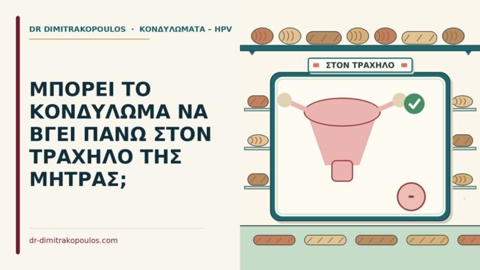 ΜΠΟΡΕΙ ΤΟ ΚΟΝΔΥΛΩΜΑ ΝΑ ΒΓΕΙ ΠΑΝΩ ΣΤΟΝ ΤΡΑΧΗΛΟ ΤΗΣ ΜΗΤΡΑΣ; τράχηλο