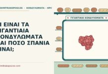 γιγαντιαία