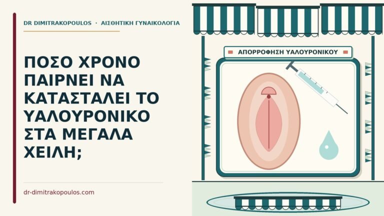 υαλουρονικό στα μεγάλα χείλη
