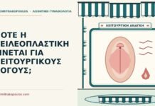 ΠΟΤΕ Η ΧΕΙΛΕΟΠΛΑΣΤΙΚΗ ΓΙΝΕΤΑΙ ΓΙΑ ΛΕΙΤΟΥΡΓΙΚΟΥΣ ΛΟΓΟΥΣ; χειλεοπλαστική για λειτουργικούς λόγους