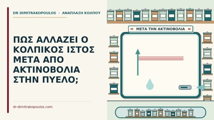 ΠΩΣ ΑΛΛΑΖΕΙ Ο ΚΟΛΠΙΚΟΣ ΙΣΤΟΣ ΜΕΤΑ ΑΠΟ ΑΚΤΙΝΟΒΟΛΙΑ ΣΤΗΝ ΠΥΕΛΟ; ακτινοβολία στην πύελο