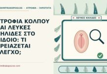 λευκές κηλίδες στο αιδοίο